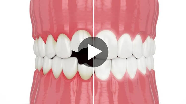 Thumbnail image for educational video on cosmetic dentistry